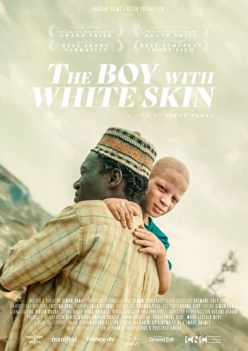 The Boy with White Skin