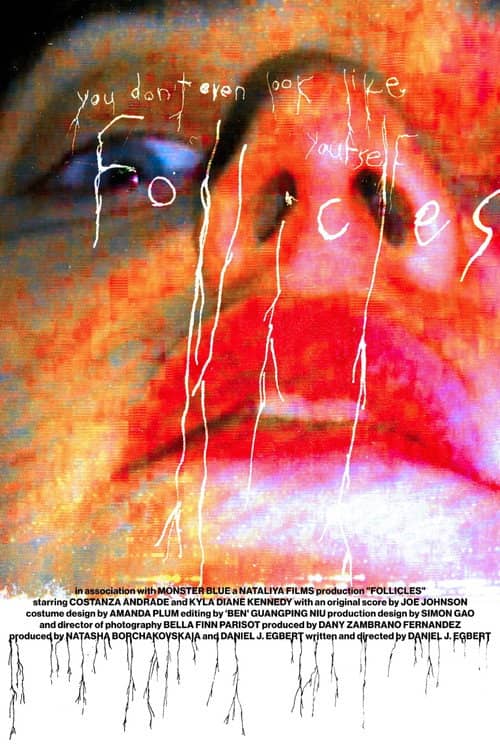 FOLLICLES