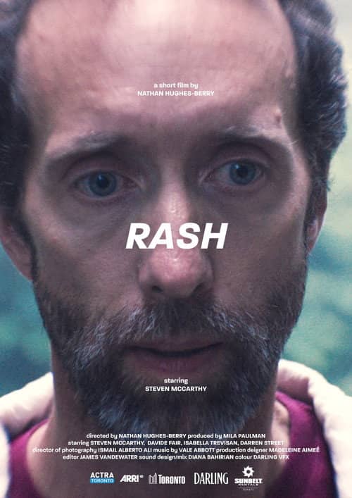 Rash