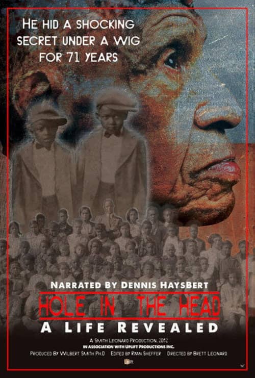 Hole in the Head: A Life Revealed
